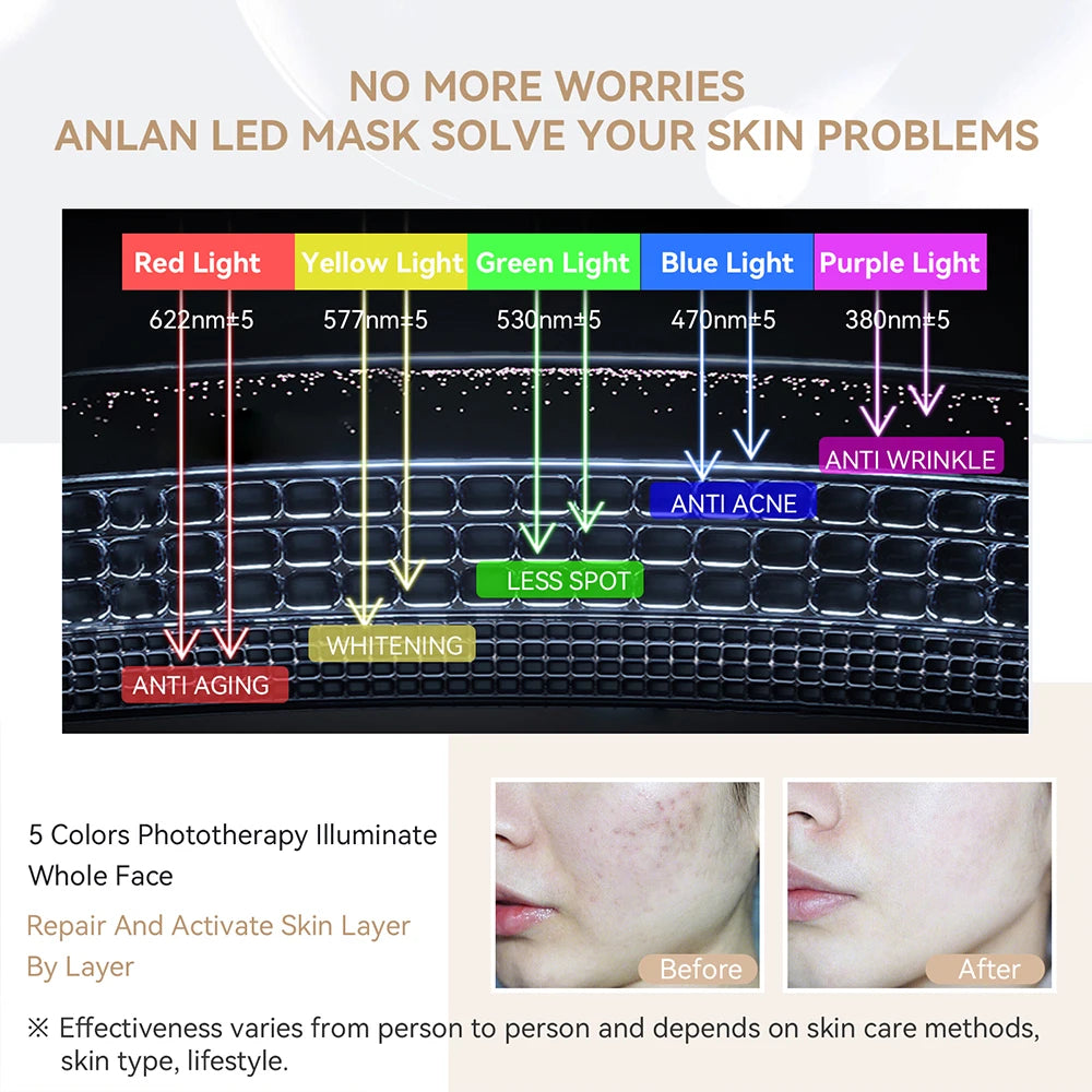 ANLAN Heating LED Beauty Mask – 5 Color LED Therapy Silicone Face Mask