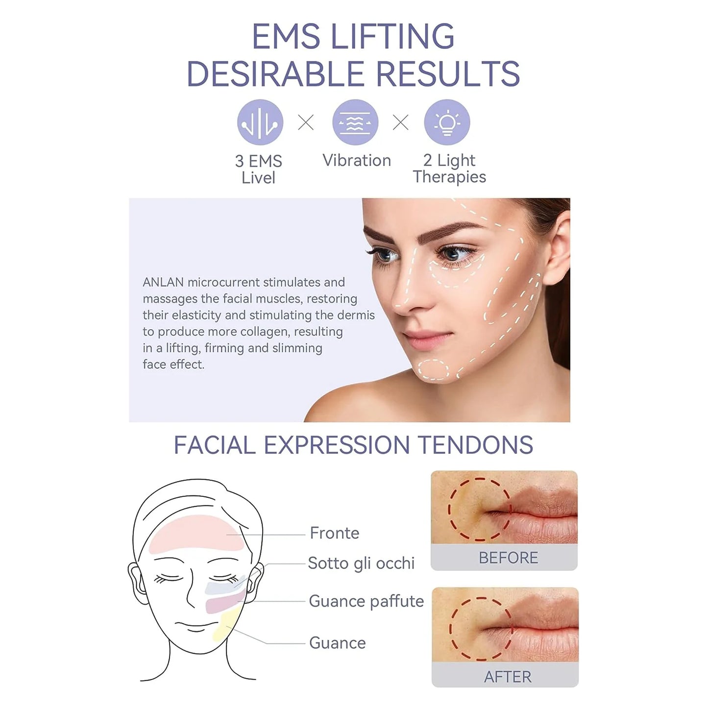 RadiantLift EMS Face Massager