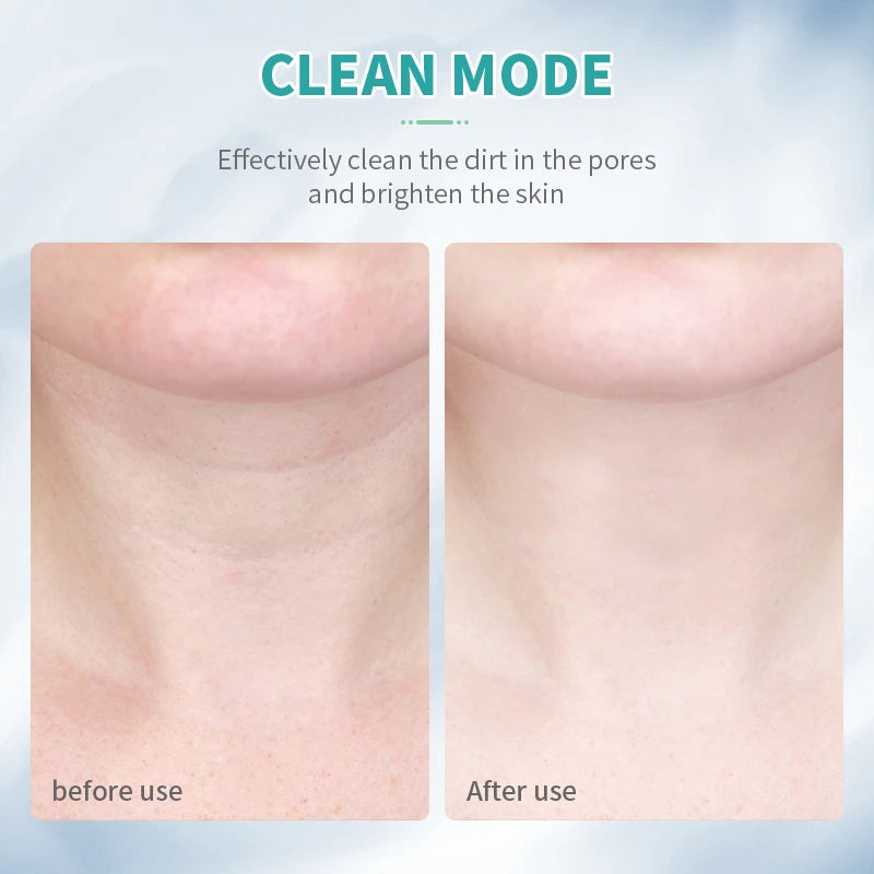 ANLAN Neck and Face Beauty Device – EMS Facial Lifting with 3 Light Colors