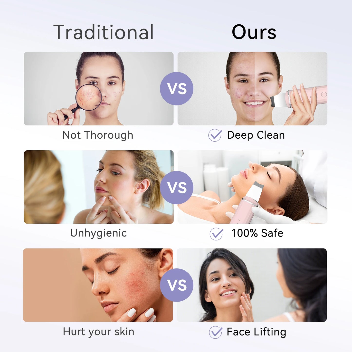 ANLAN Ultrasonic Skin Scrubber – Deep Facial Cleansing & EMS Lifting Tool
